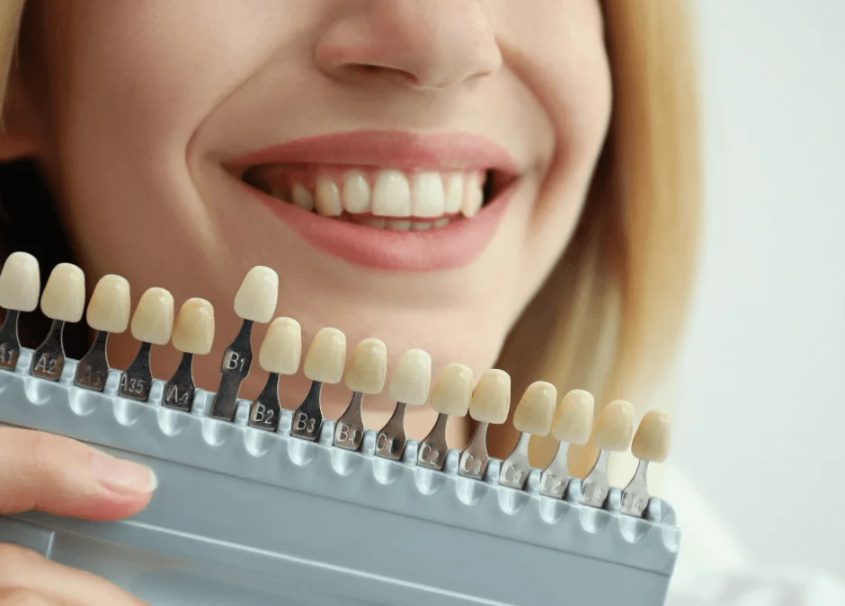 How Much Does Teeth Whitening Cost?