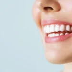 Teeth Whitening Tips